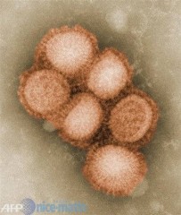 GrippePorcine1.jpg