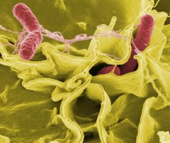bactérie-la-salmonelle-f0398.jpg