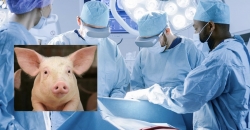 porc,coeur,opération,dvis bennett,chirurgie,révolutionnaire,transplantation