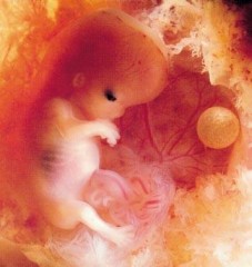 avortement4.jpg