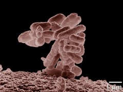 bacterieescheri--enterohemorragique-un0.jpg