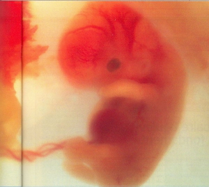 cellules souches,ovule,embryon,CEJ,cour européenne,parthénogenèse,fécondation,foetus,