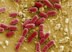 bacterie-allemagne-20110604.jpg